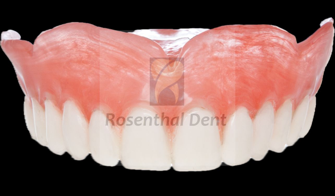 Close-up of flexible ThermoPlas denture highlighting comfort, gum-like flexibility, and natural look