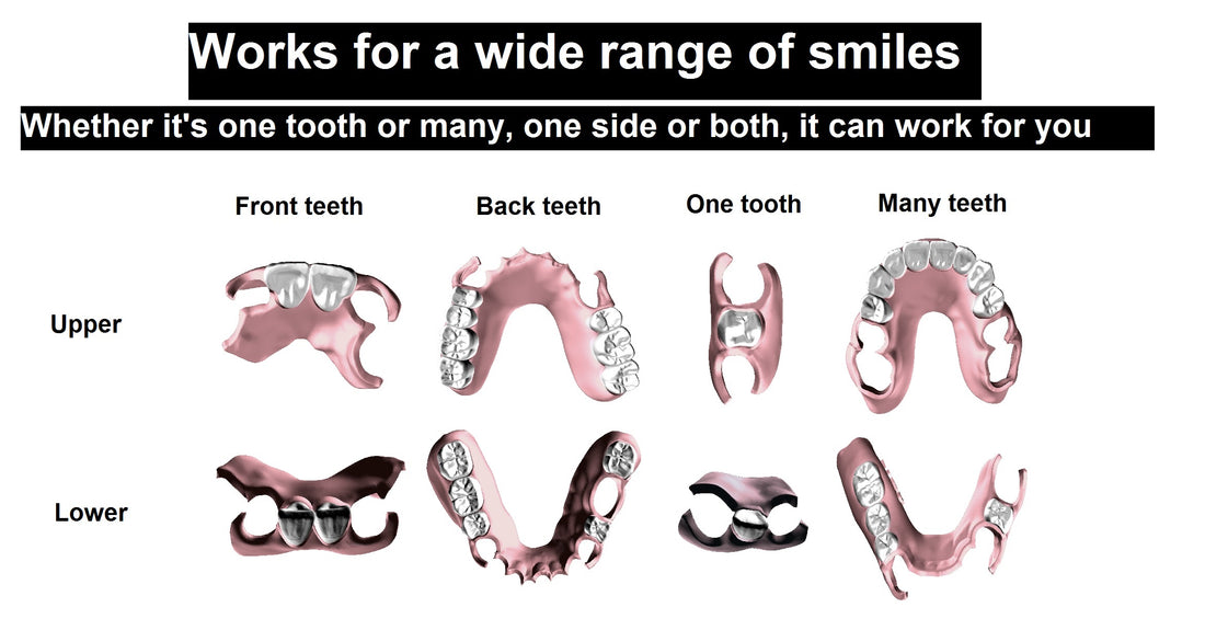 Complete full denture set for upper and lower arches. Custom-made for comfort and aesthetics by YourDentureStore.com.