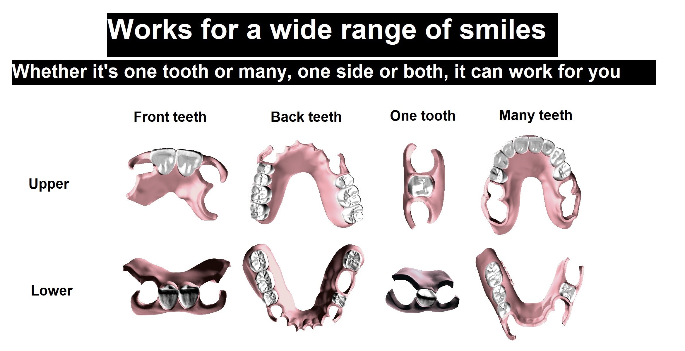 Complete full denture set for upper and lower arches. Custom-made for comfort and aesthetics by YourDentureStore.com.