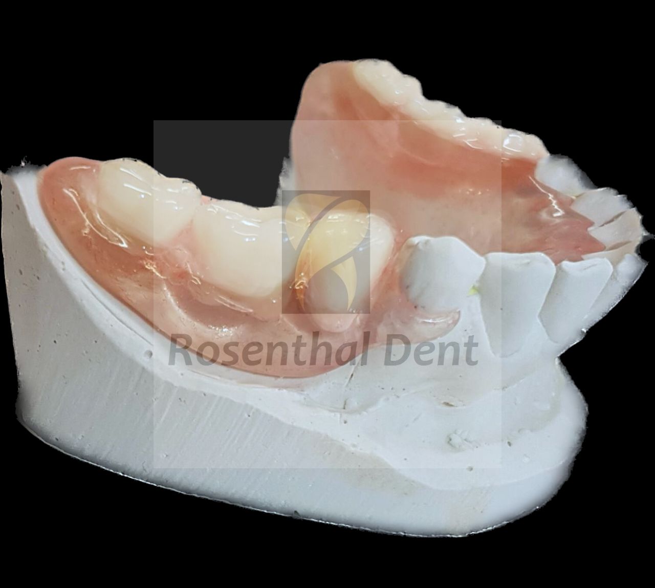 Custom partial ThermoPlas flexible denture prices - budget-friendly dental solutions.