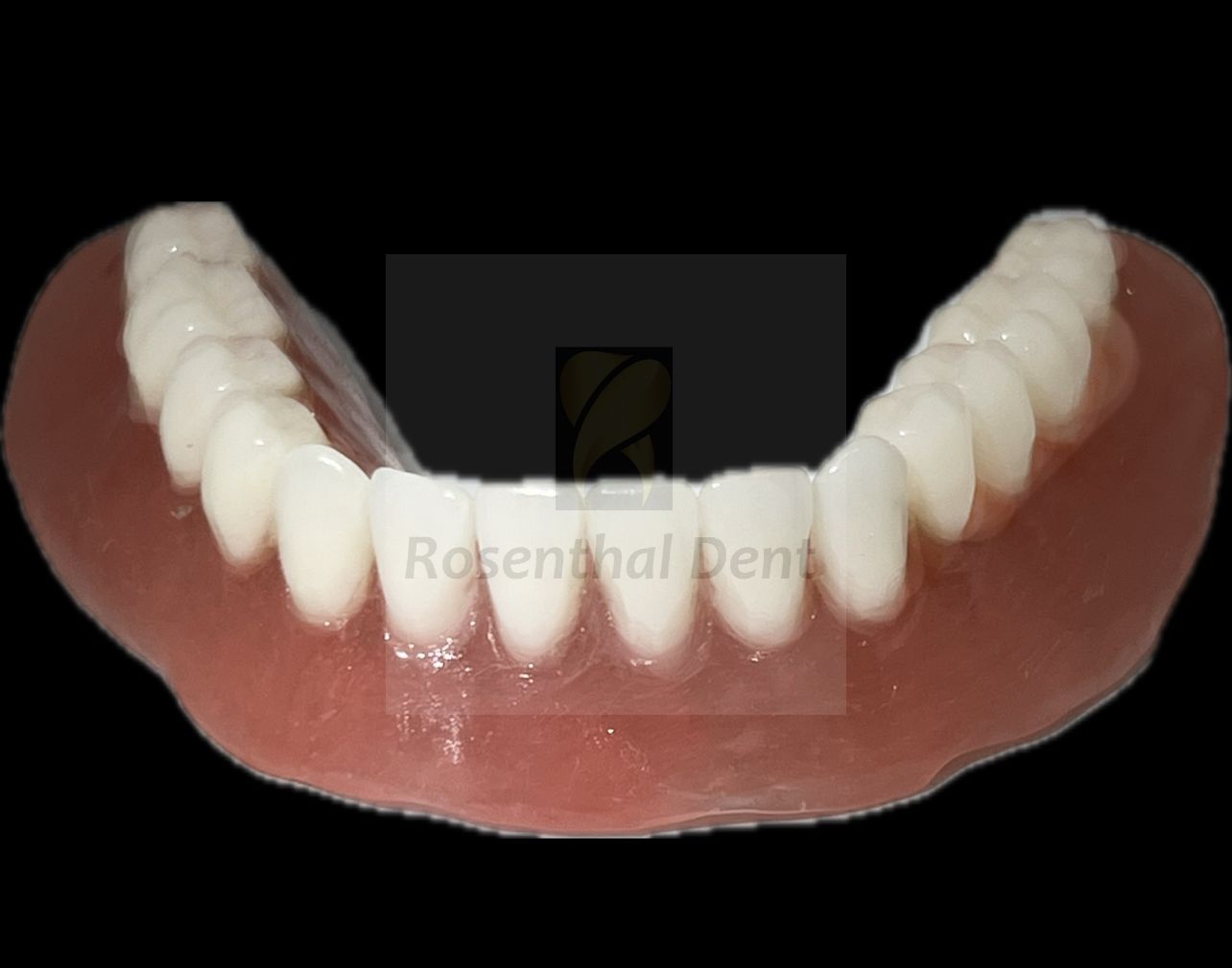 High-quality flexible full arch ThermoPlas denture at a cheap online price.