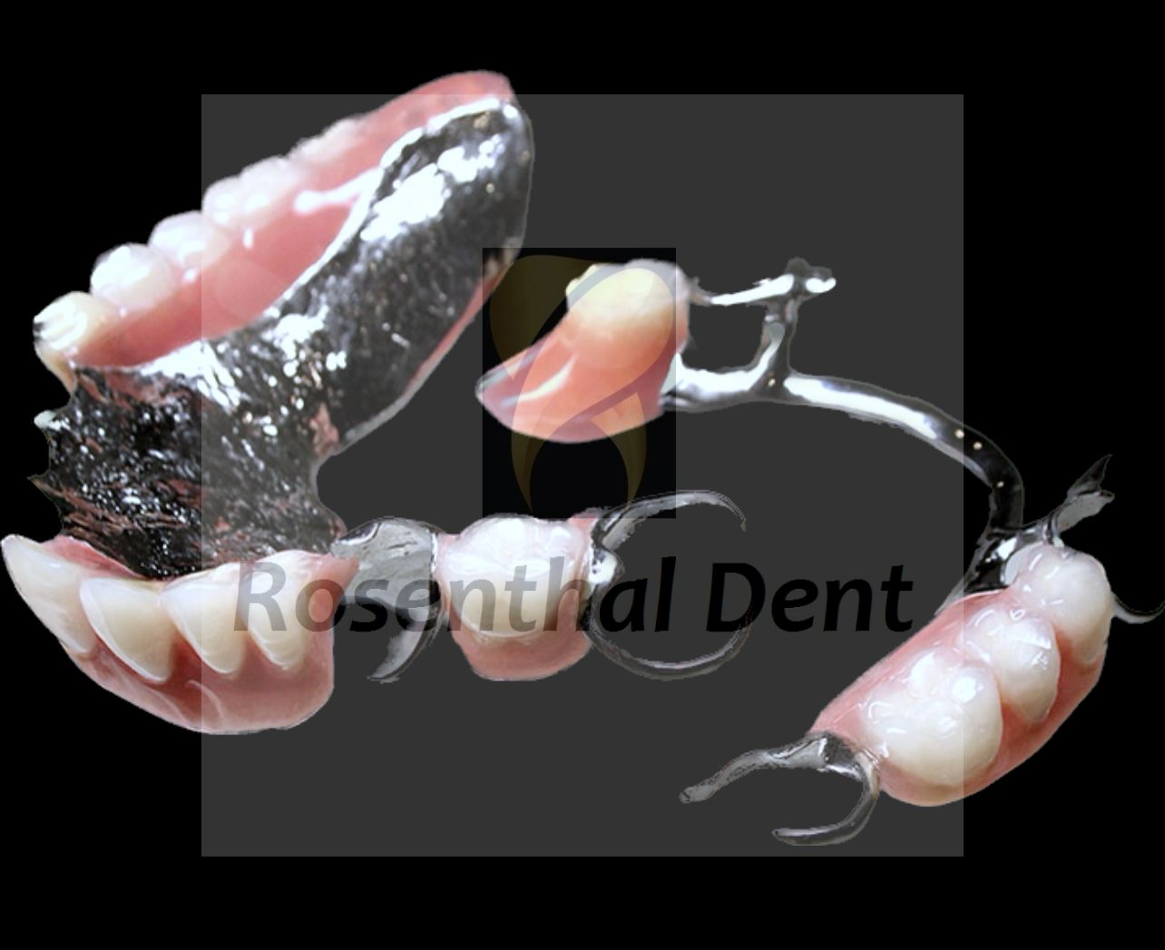 Custom-Made Cobalt Chrome Full or Partial Denture for a Perfect Fit