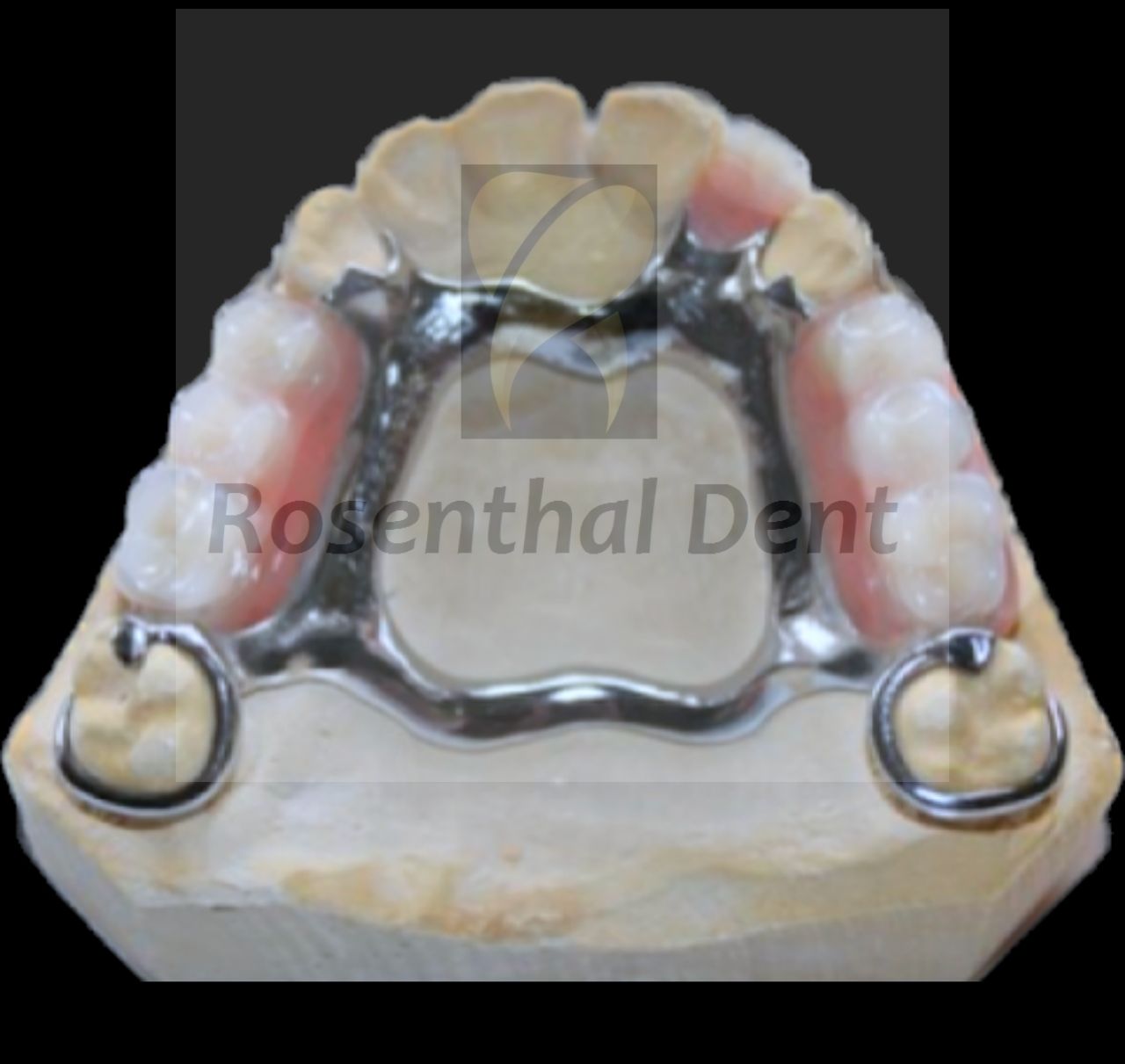High-Quality Cobalt Chrome Denture - Full and Partial Options Available