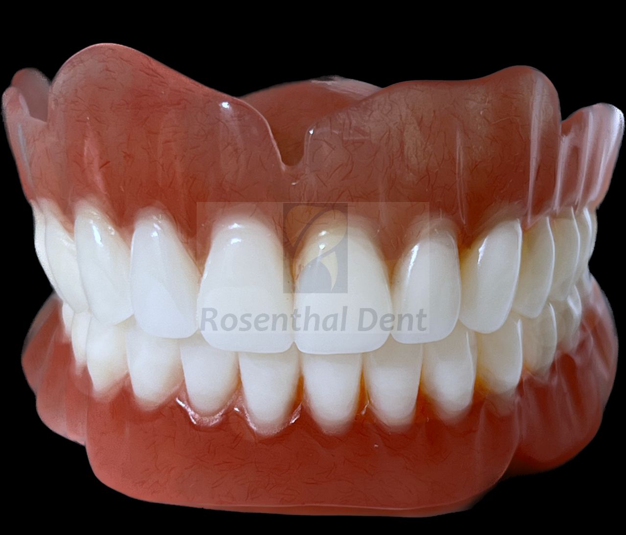 Custom full arch acrylic denture made for a perfect, comfortable fit.