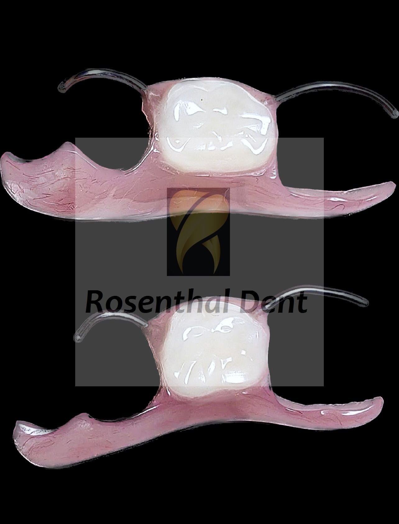 Custom Nesbit Flipper Acrylic Partial Denture – Comfortable and natural-looking.