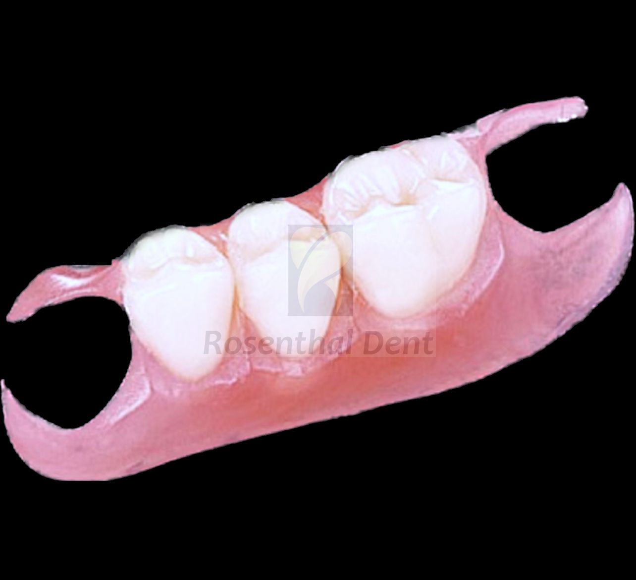 Find out the online cost of a Custom Nesbit - Flipper ThermoPlas Flexible Partial Denture.