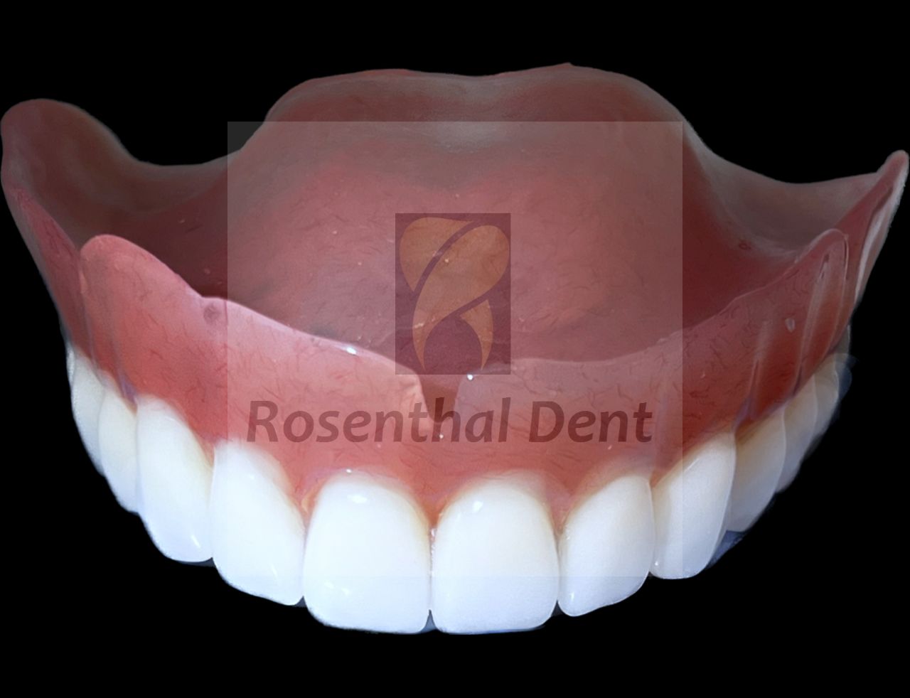 Lightweight and natural-looking full arch acrylic denture for daily use.
