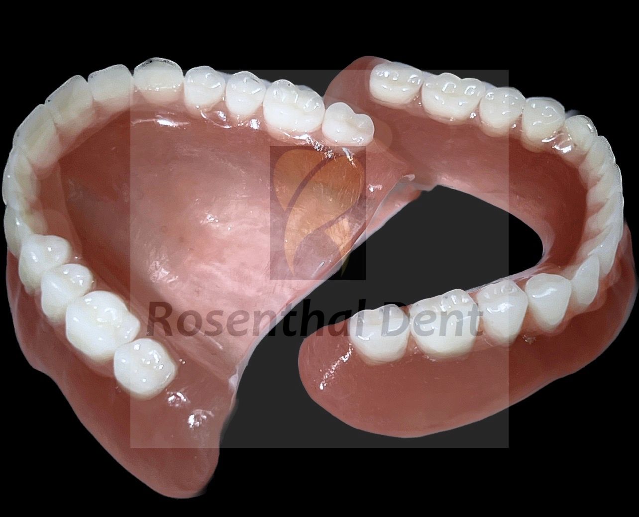 High-quality full arch acrylic denture designed to restore your smile.