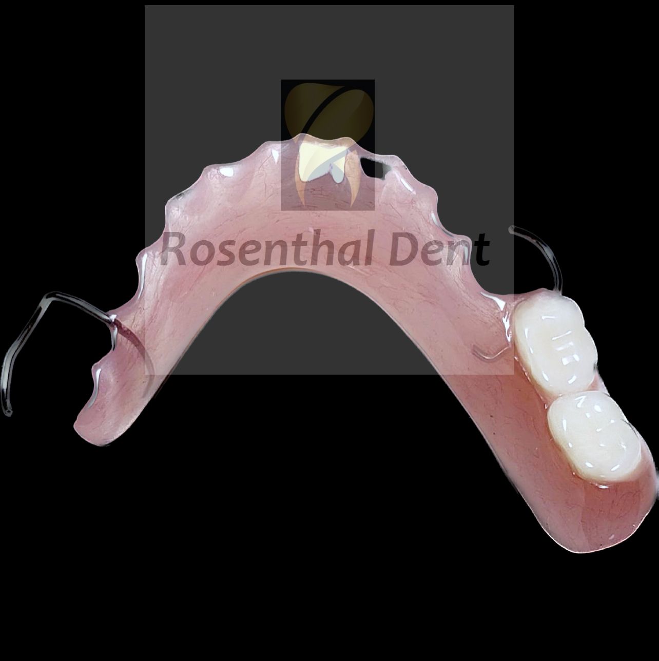 Affordable acrylic Nesbit flipper denture for replacing missing teeth.