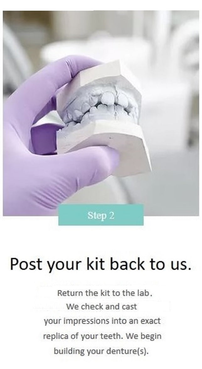 High-quality permanent partial acrylic denture with a custom fit.