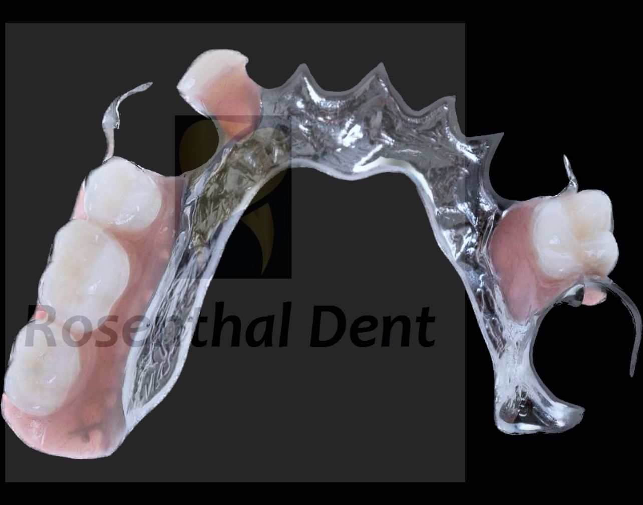 Close-up of cobalt chrome denture showing slim metal framework and durable design