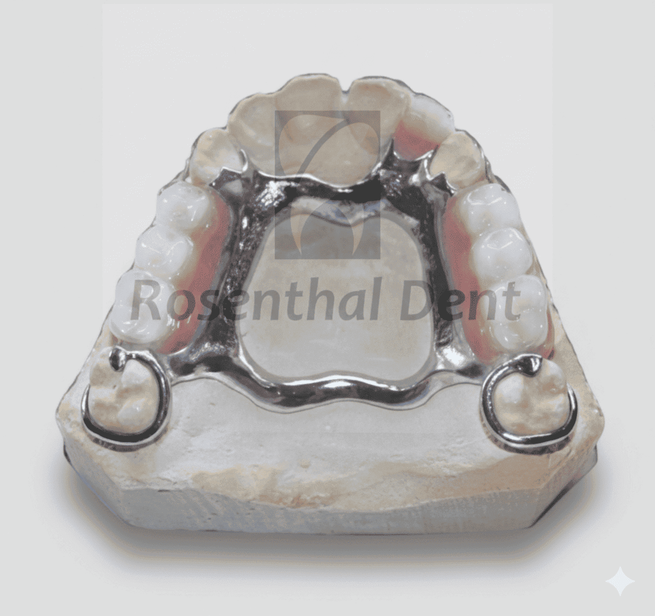 High-Quality Cobalt Chrome Denture - Full and Partial Options Available