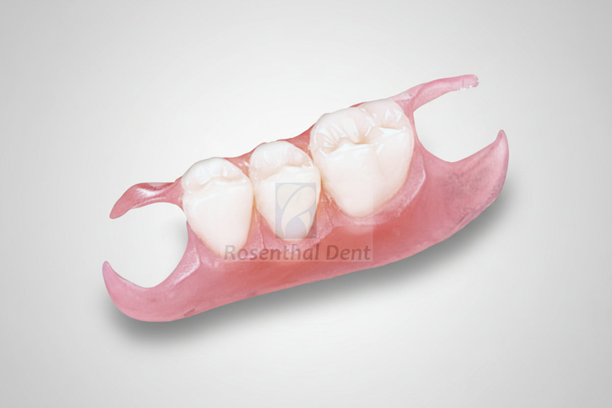 Single Tooth Removable Partial Denture