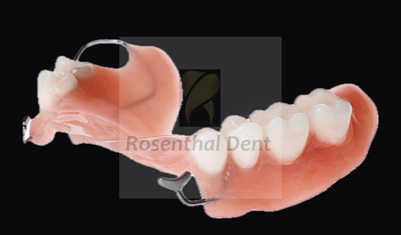 Custom partial acrylic denture online - permanent solution for lasting comfort.