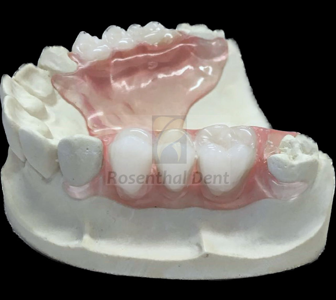 Custom Partial ThermoPlas Flexible Denture