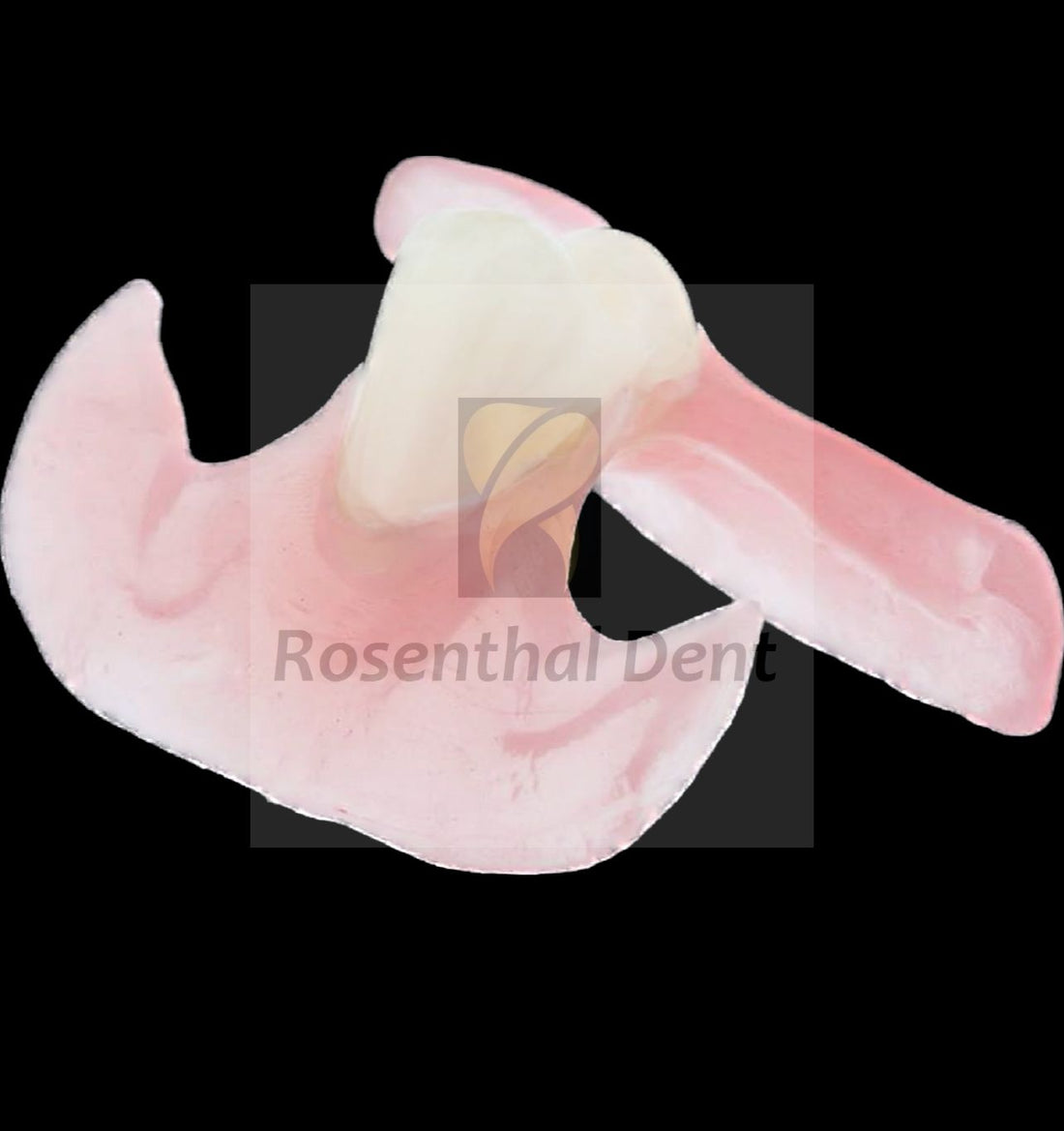 Custom Nesbit - Flipper ThermoPlas Flexible Partial Denture